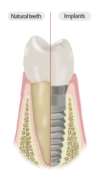 iNCREMENTAL DENTAL HEALTH CARE SYSTEM | Gangnam Dental Clinic